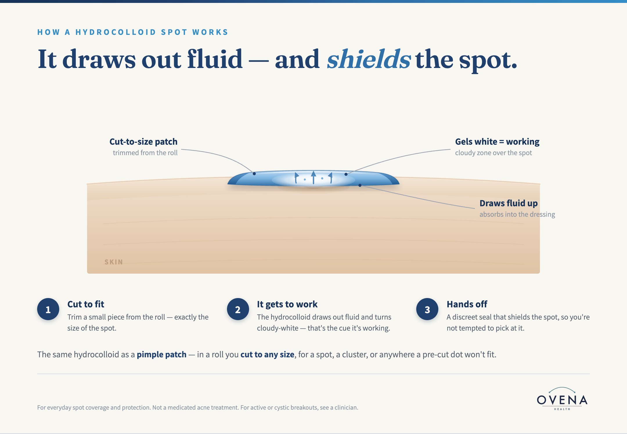 Diagram: how a hydrocolloid patch works — cut to size, draws fluid and turns white, shields the spot in a moist seal.